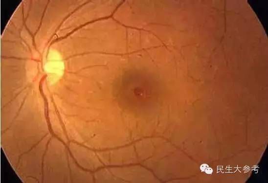 Σ�U(xi��n)�������ď���Ƭ�������۾�Ϲ����9�N�e(cu��)�`�e�ٷ�