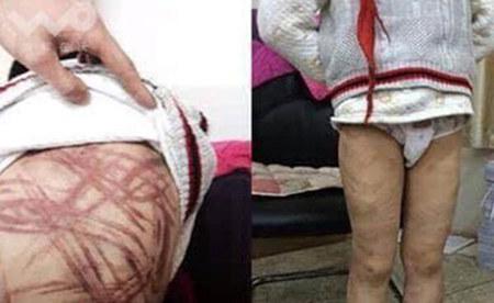 �����P(gu��n)ע�ġ��Ͼ�Űͯ������������11��20������9�r���Ͼ�����Ժ�_ͥ���������죬�F(xi��n)�����ӛ�߷քe�ĺ������B(y��ng)ĸ�����ٵĴ����Ɏ�̎�˽⵽��11��13�������������յ����Ͼ�����Ժ�_֪ͥͨ�������ٹ������һ�������Ͼ�����Ժ�������ͥ�����������幫�_������