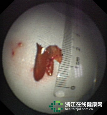 �����ס����β������ǆ��M�������Ƥ�ǵ����D��