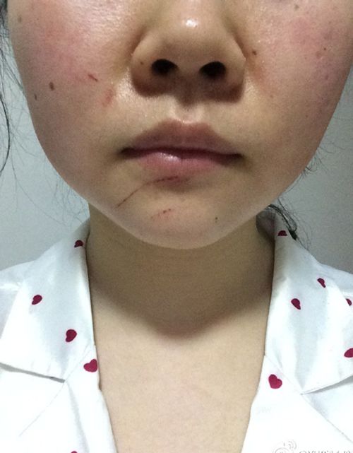 �|���W(w��ng)ӛ�����4��26�Ո�(b��o)����������΢���W(w��ng)��@��A�A-2016�Q�����ɽ���һ����Ժͣ܇����һİ�������ԷQ������������܇���c(di��n)��͵���ɣ�Ҫ�����ȥ����������ܴ�110��(b��o)��������������늓����u�����������I(l��ng)��δ�������p���m�p������������