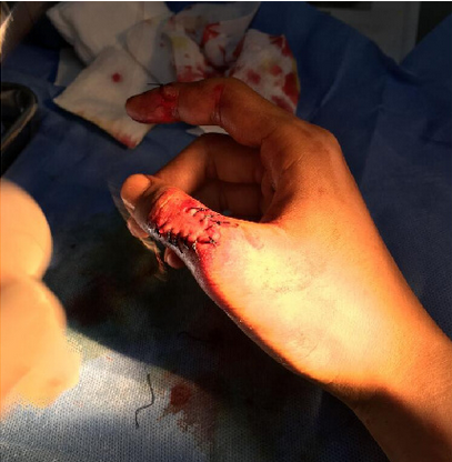 �W(w��ng)��ӆ�ͽo���u(p��ng) �Ñ�(h��)�����p19�