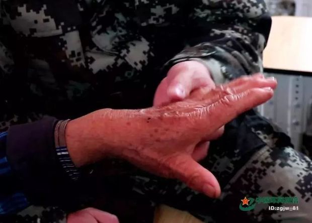 �@�β���30���ҕ�l��׌܊�˸е�ů����